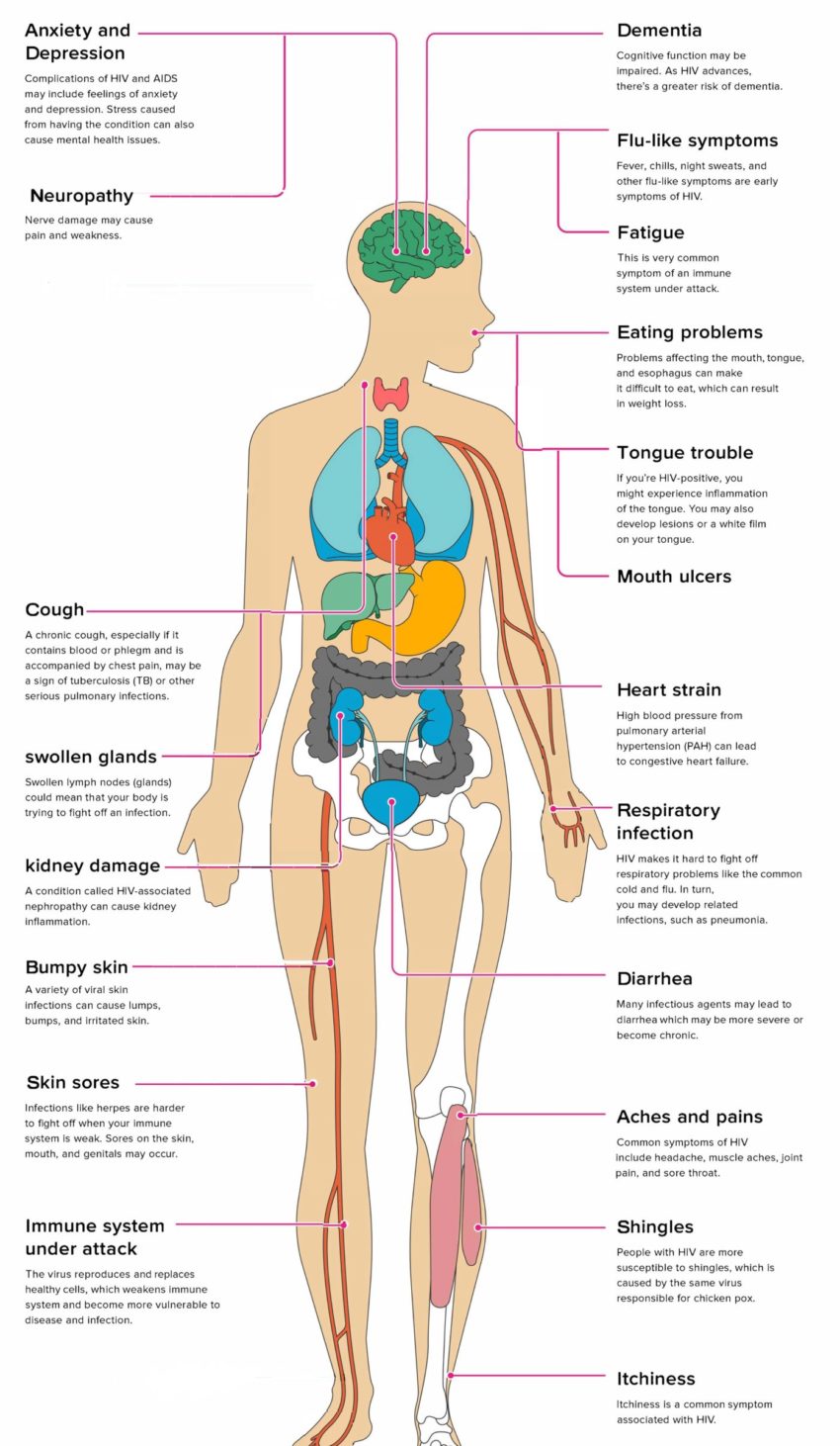 Symptoms of HIV