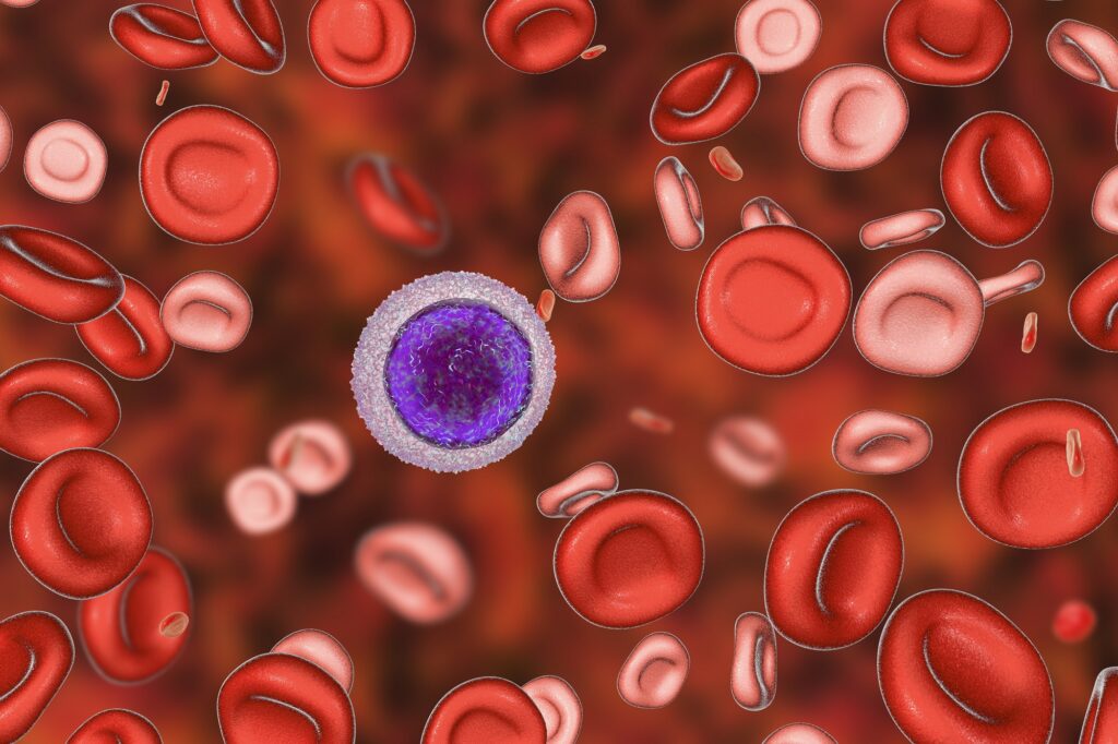 Thalassemia