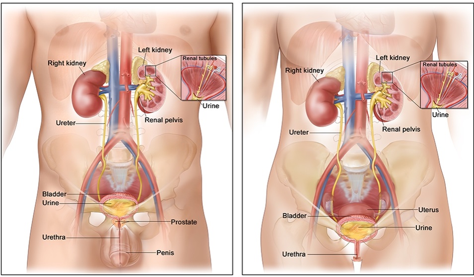 BLADDER CANCER